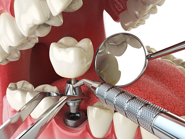 Best Walk-In Emergency Dentist in Elmwood, IL
